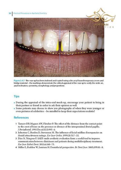 Practical Procedures in Aesthetic Dentistry
