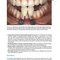 Practical Procedures in Aesthetic Dentistry