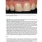 Practical Procedures in Aesthetic Dentistry