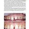 Practical Procedures in Aesthetic Dentistry