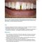 Practical Procedures in Aesthetic Dentistry