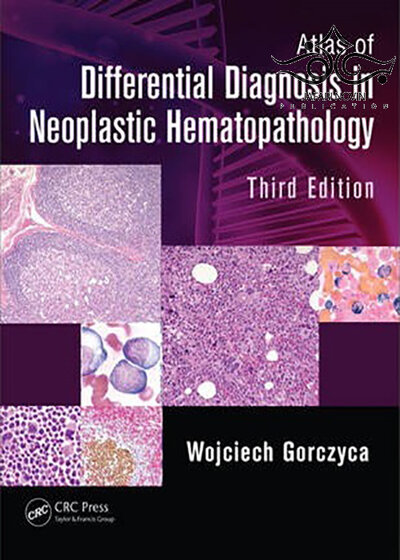 Atlas of Differential Diagnosis in Neoplastic Hematopathology, 3rd Edition2014 اطلس تشخیص افتراقی در خون شناسی نئوپلاستیک