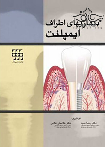بیماریهای اطراف ایمپلنت