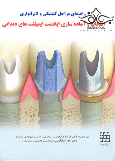 راهنمای مراحل کلینیکی و لابراتواری انتخاب و آماده سازی اباتمنت ایمپلنت های دندانی