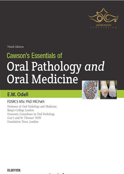 Cawson's  Essentials of Oral Pathology and Oral Medicine 2017 9th , Kindle Edition ضروریات آسیب شناسی دهان و پزشکی دهان و دندان 2017