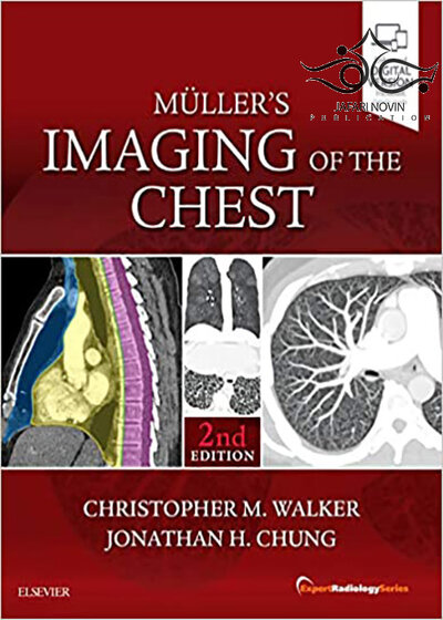 Muller’s Imaging of the Chest, 2nd Edition2018