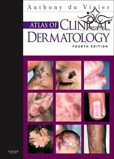 Atlas of Clinical Dermatology, 4th Edition