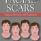 Facial Scars: Surgical Revision and Treatment2017