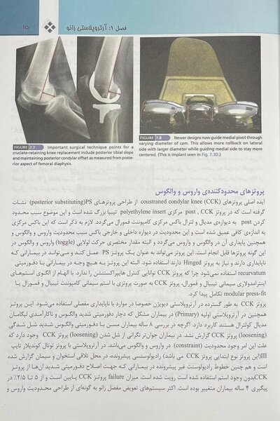 جراحی ارتوپدی زانو کمپل 2021