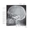 Netter Atlas of HUMAN ANATOMY 8e 2023 (تحریر)