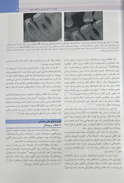 اندودانتیکس اینگل 2019 جلد 2