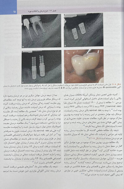اندودانتیکس اینگل 2019 جلد 2