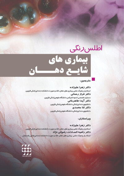 اطلس رنگی بیماری های شایع دهان