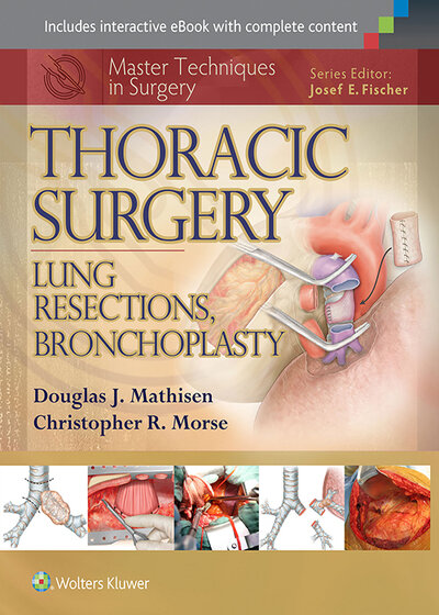 کتاب Master Techniques in Surgery: Thoracic Surgery: Lung Resections, Bronchoplasty