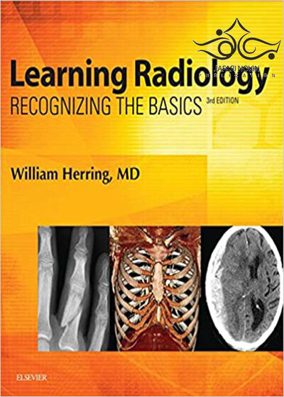 Learning Radiology: Recognizing the Basics
