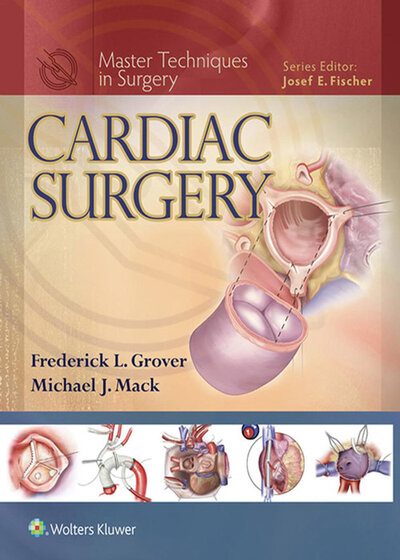 Cardiac Surgery (Master Techniques in Surgery)
