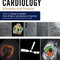 Interventional Cardiology : Principles and Practice
