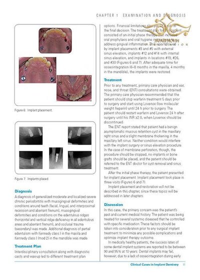 Clinical Cases in Implant Dentistry