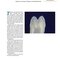 Preservation and Restoration of Tooth Structure 2016 حفظ و ترمیم ساختار دندان