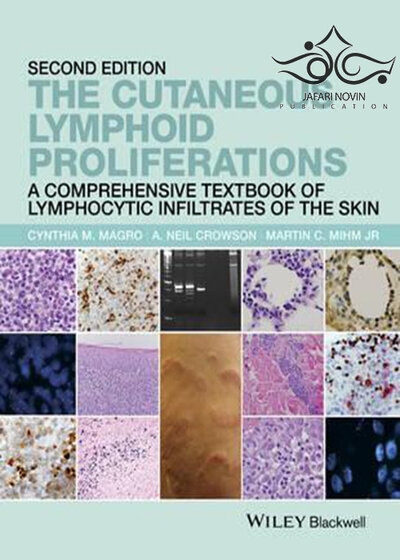 The Cutaneous Lymphoid Proliferations: A Comprehensive Textbook of Lymphocytic Infiltrates of the Skin 2nd Edition, Kindle Edition