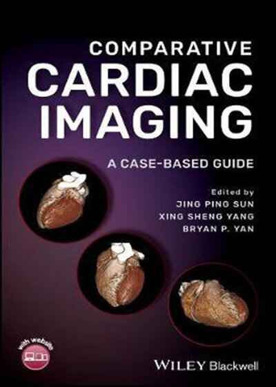 Comparative Cardiac Imaging, A Case‐based Guide