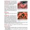 Extraordinary Cases in Emergency Medicine 2019