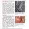 Extraordinary Cases in Emergency Medicine 2019