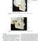 Management of Temporomandibular Disorders and Occlusion 2020