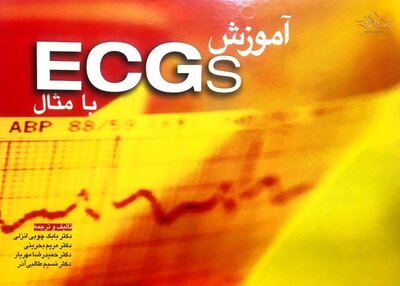 آموزش ECGs با مثال