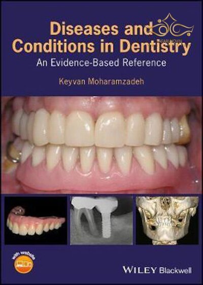 Diseases and Conditions in Dentistry: An Evidence-Based Reference 1st Edition 2018  بیماریها و شرایط در دندانپزشکی: یک مرجع مبتنی بر شواهد