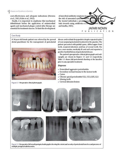 Diseases and Conditions in Dentistry: An Evidence-Based Reference 1st Edition 2018  بیماریها و شرایط در دندانپزشکی: یک مرجع مبتنی بر شواهد