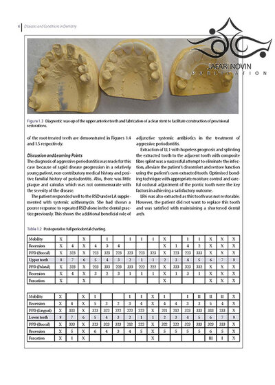 Diseases and Conditions in Dentistry: An Evidence-Based Reference 1st Edition 2018  بیماریها و شرایط در دندانپزشکی: یک مرجع مبتنی بر شواهد