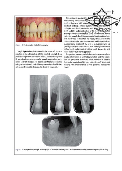 Diseases and Conditions in Dentistry: An Evidence-Based Reference 1st Edition 2018  بیماریها و شرایط در دندانپزشکی: یک مرجع مبتنی بر شواهد