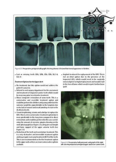 Diseases and Conditions in Dentistry: An Evidence-Based Reference 1st Edition 2018  بیماریها و شرایط در دندانپزشکی: یک مرجع مبتنی بر شواهد