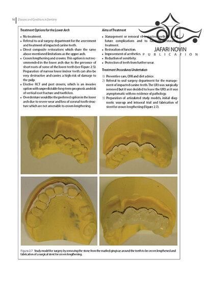 Diseases and Conditions in Dentistry: An Evidence-Based Reference 1st Edition 2018  بیماریها و شرایط در دندانپزشکی: یک مرجع مبتنی بر شواهد