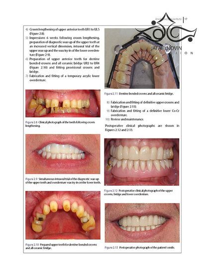 Diseases and Conditions in Dentistry: An Evidence-Based Reference 1st Edition 2018  بیماریها و شرایط در دندانپزشکی: یک مرجع مبتنی بر شواهد
