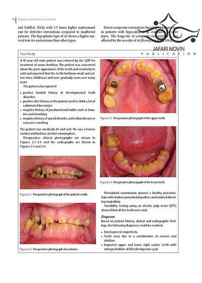 Diseases and Conditions in Dentistry: An Evidence-Based Reference 1st Edition 2018  بیماریها و شرایط در دندانپزشکی: یک مرجع مبتنی بر شواهد