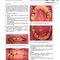 Diseases and Conditions in Dentistry: An Evidence-Based Reference 1st Edition 2018  بیماریها و شرایط در دندانپزشکی: یک مرجع مبتنی بر شواهد