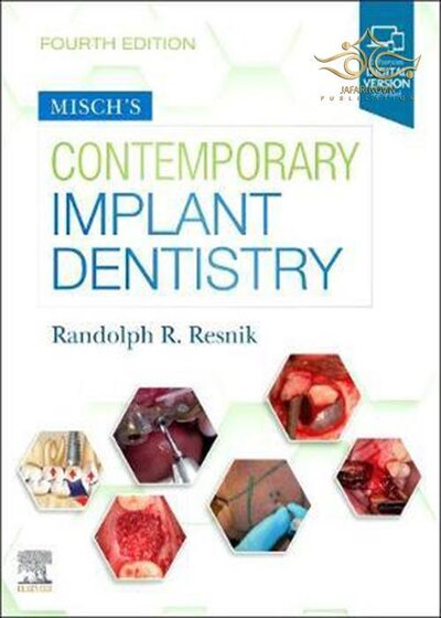 2021 Misch's Contemporary Implant Dentistry 4th Edition