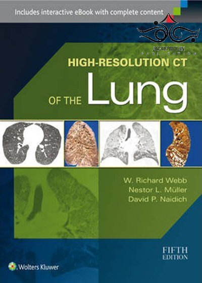 High-Resolution CT of the Lung Fifth Edition2014