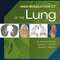 High-Resolution CT of the Lung Fifth Edition2014