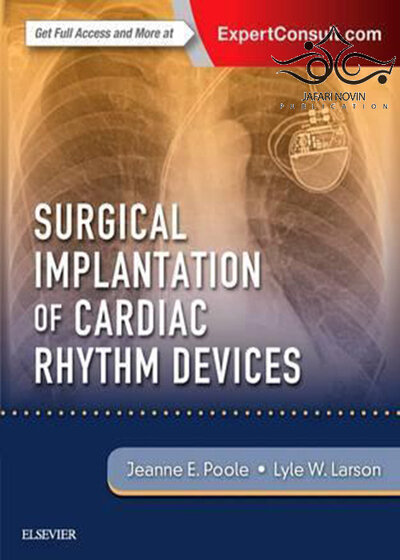 Surgical Implantation of Cardiac Rhythm Devices, 1e Edition2017 کاشت جراحی دستگاه های ریتم قلب