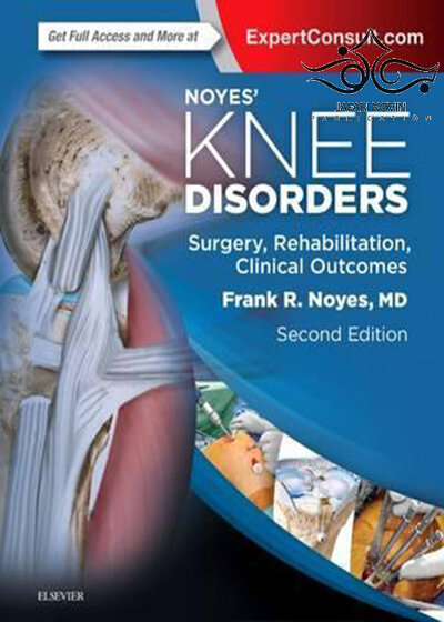 Noyes’ Knee Disorders: Surgery, Rehabilitation, Clinical Outcomes, 2nd Edition 2016
