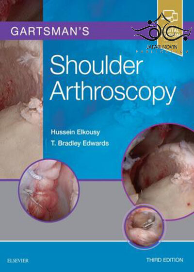 Gartsman’s Shoulder Arthroscopy 3rd Edition2018