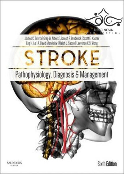 Stroke: Pathophysiology, Diagnosis, and Management 6th Edition2015