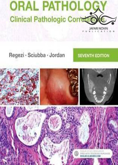 Oral Pathology: Clinical Pathologic Correlations 7th Edition2016 آسیب شناسی دهان و دندان