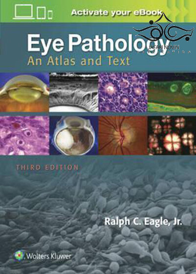 Eye Pathology, 3th Edition2016 آسیب شناسی چشم
