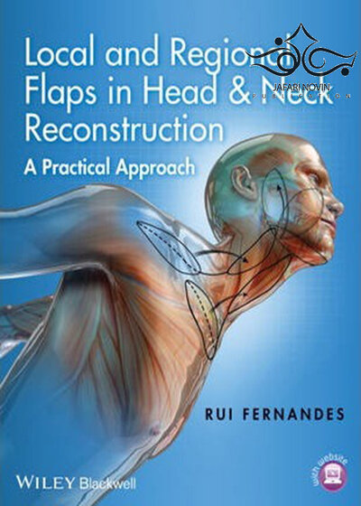 Local and Regional Flaps in Head and Neck Reconstruction2017