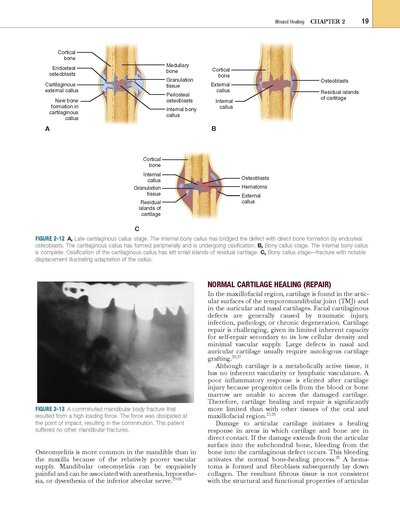 Oral and Maxillofacial Trauma 4th Edition2012