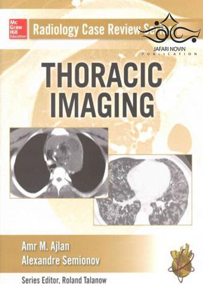 Radiology Case Review Series: Thoracic Imaging2016 مجموعه بررسی موارد رادیولوژی: تصویربرداری قفسه سینه